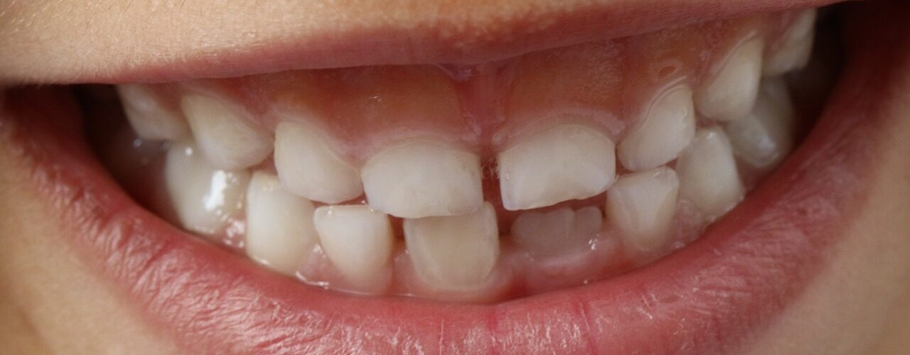 Zahnhygiene